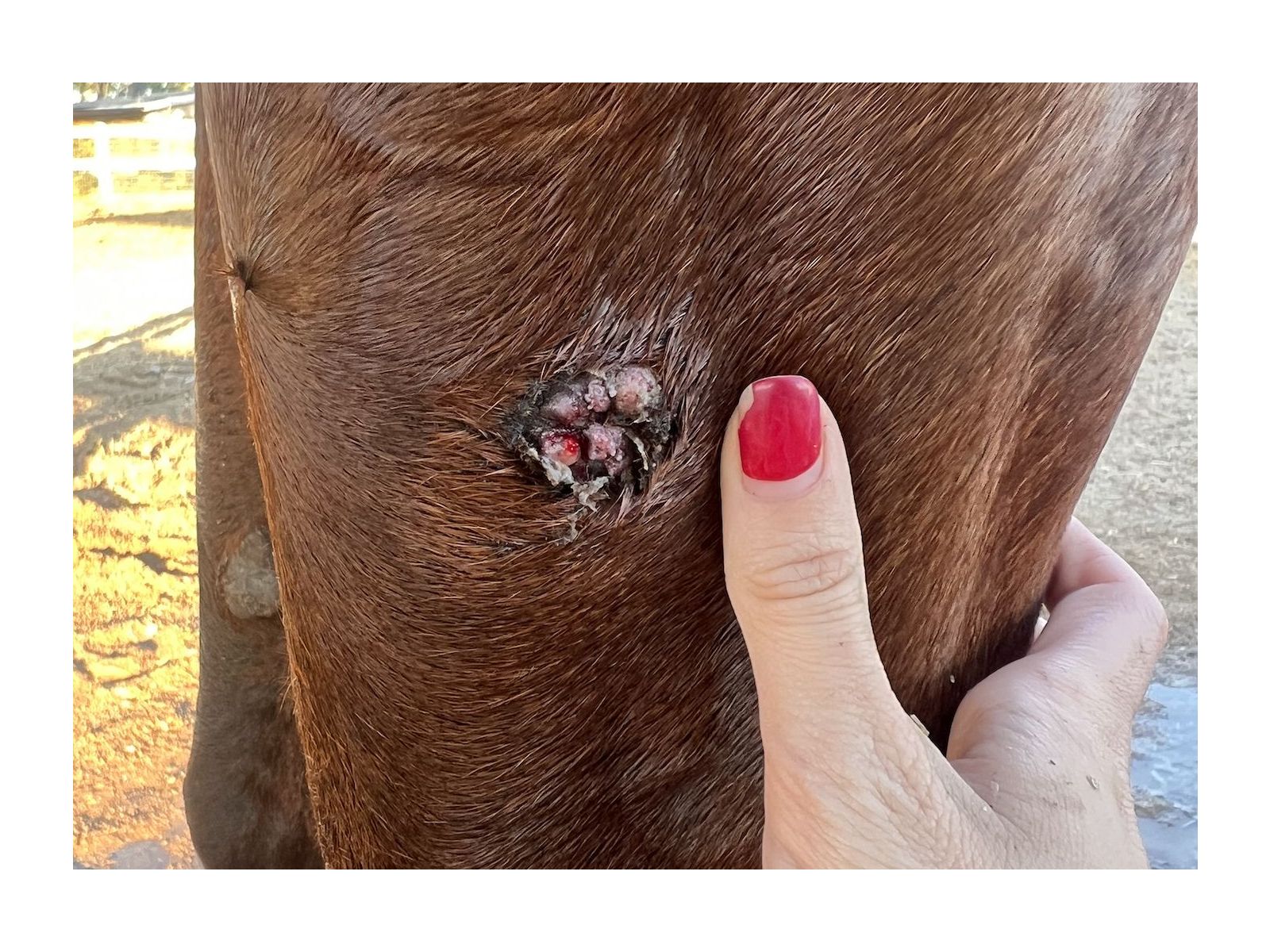 Harry's successful sarcoid treatment