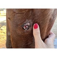 Harry's successful sarcoid treatment