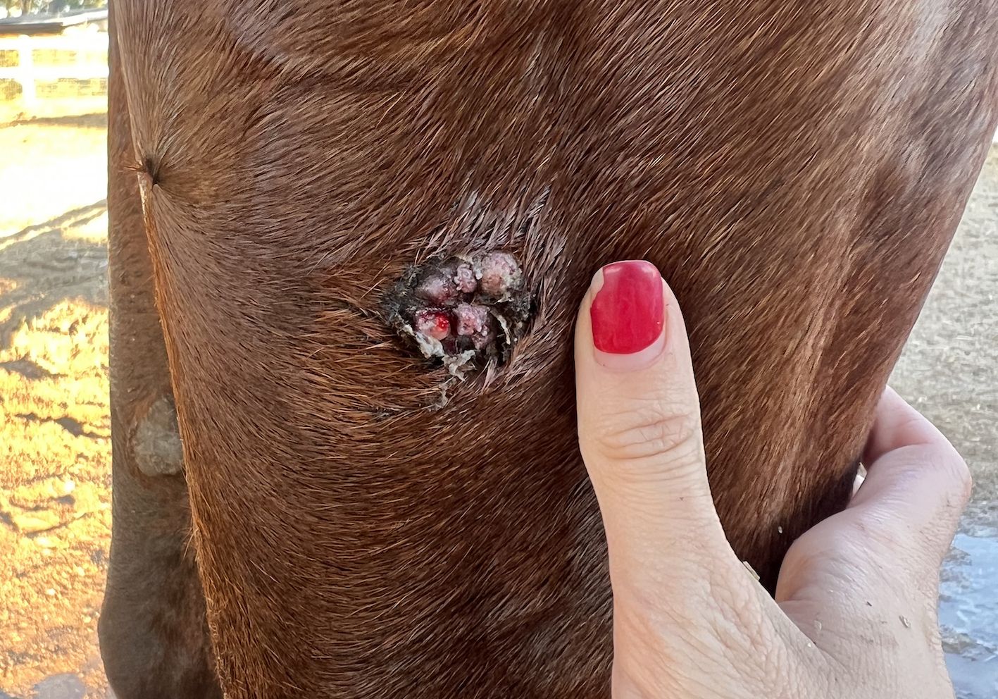 Harry's successful sarcoid treatment